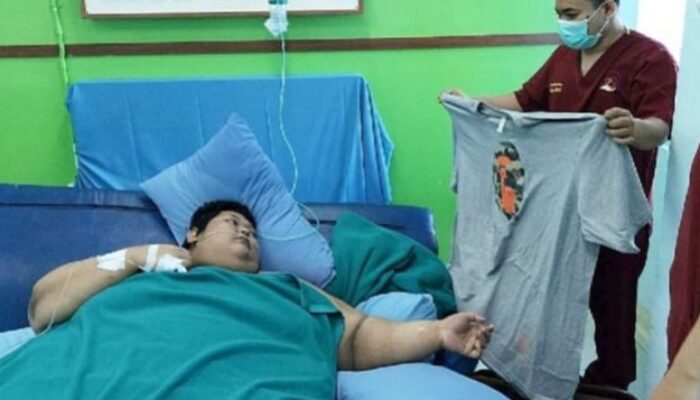 Fajri, Pria Berbobot 300 Kg Dirawat di Ruang Rawat Khusus di RSCM